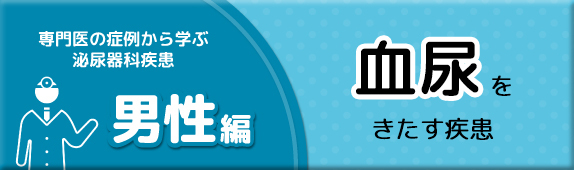 専門医の症例から学ぶ泌尿器科疾患 男性の血尿をきたす疾患